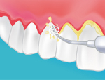 centre dentaire reims