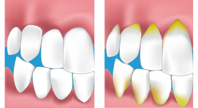 dentiste reims